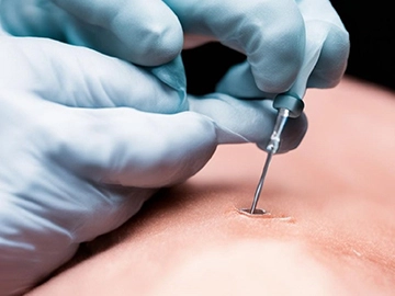 Запишись на прием к урологу